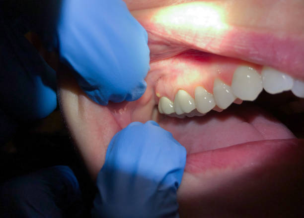 Best Emergency Dentist Open Today  in Des Peres, MO